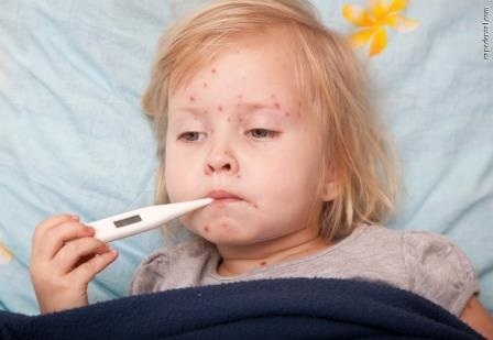 Що потрібно знати, щоб ваша дитини не захворіла на кір?