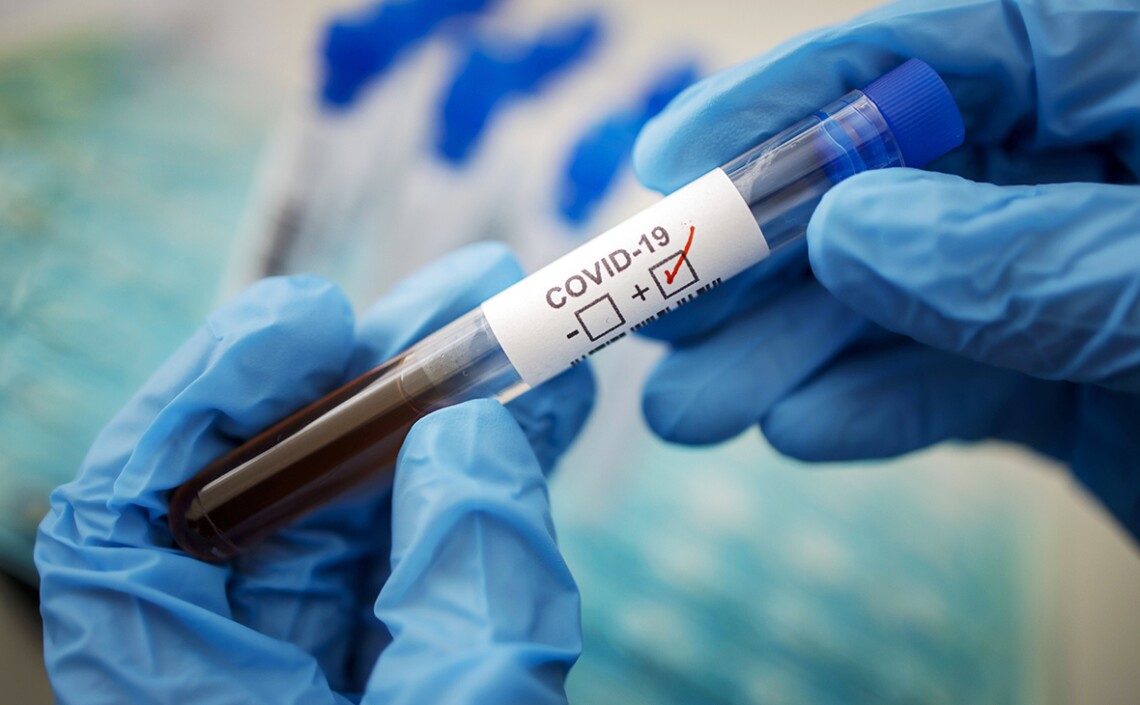 Епідемічна ситуація щодо поширення коронавірусної хвороби COVID-19 в Житомирській області за 38 тиждень ( 19.09-25.09.2022)